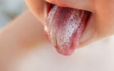 White coating on baby tongue
